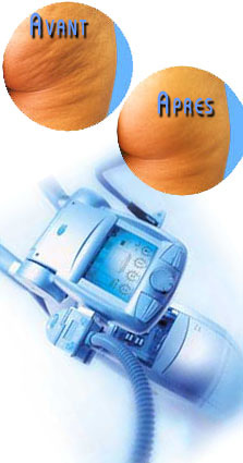 Institut Annabella, Bevilacqua,anna Bevilacqua, Th&eacute;rapeute, Gen&egrave;ve,aquasoins,suisse,m&eacute;decine naturelle,Institut de beaut&eacute;,drainage lymphatique m&eacute;thode Vodder, &eacute;pilations, forfaits, enveloppement d'algues, produits Decl&eacute;or,Arabesque, D&eacute;tente, Krishnamuti, aloe vera, laser, &eacute;pilation laser, photonius, &eacute;pilation d&eacute;finitive, bulbe, cr&egrave;me d&eacute;pilatoire, poil, lampe flash, anag&egrave;ne, catag&egrave;ne, soleil, solarium, endermologie, soins, visage, institut de beaut&eacute;, m&eacute;dical, cabinet, yves rocher, maquillage, soins du corps, soins du vidage, esth&eacute;tique, chirurgie, maquillage, lifting, soins lift, traitement des cicatrices, buste, aromath&eacute;rapie, relaxation, amincissant, visagiste, sant&eacute;, bien-&ecirc;tre, huiles essentielles, huiles, maladies, cerveau, probl&egrave;mes digestifs, relaxant, parfums,blanchiment dents, soins dentaire, sourire, s&eacute;duction, blanchissement des dents en France, blanchissement des dents en Suisse, sourire &eacute;tincelant, sourire &eacute;clatant, dents blanches pas cher, gel blanchissant,dentiste Gen&egrave;ve, dentiste Suisse,esth&eacute;tique dentaire,bandes de blanchissement.